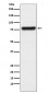 KLKB1 Antibody